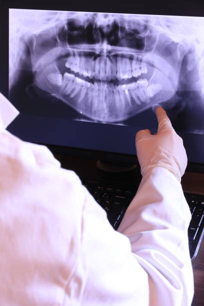 Best Emergency Root Canal Treatment in Petersburg, VA